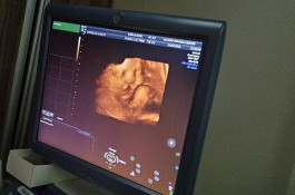  سونوگرافی داپلر در بارداری