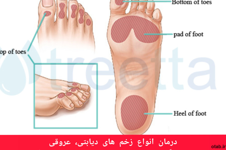 کلینیک دیابت و ترمیم زخم