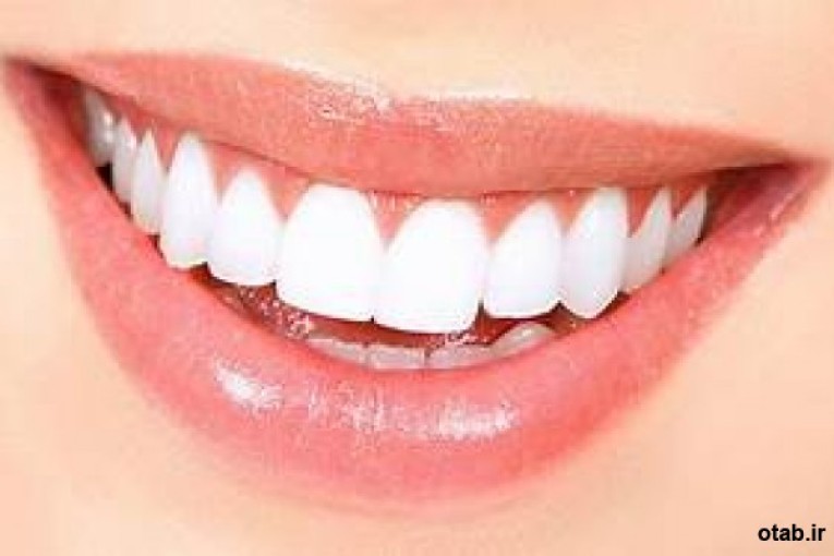 پودر سفید کننده دندان تاچ می