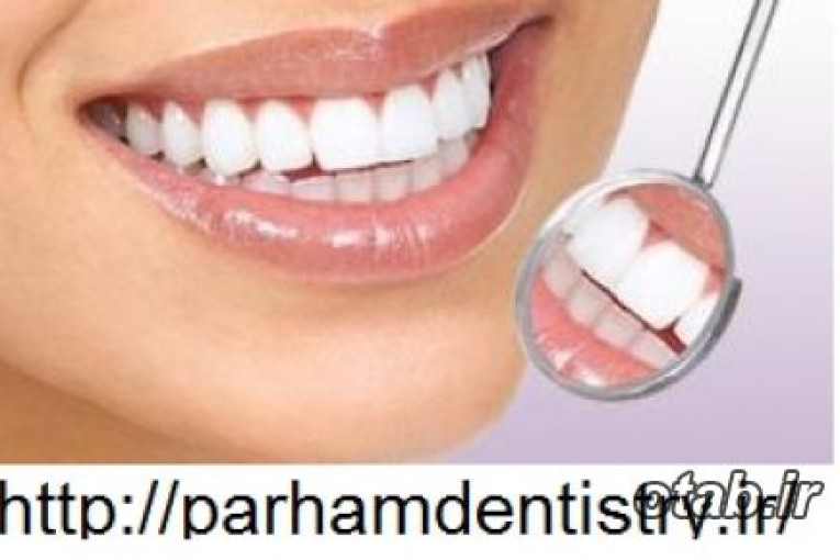 پنج روش در دندانپزشکي زيبايي براي اصلاح طرح لبخند
